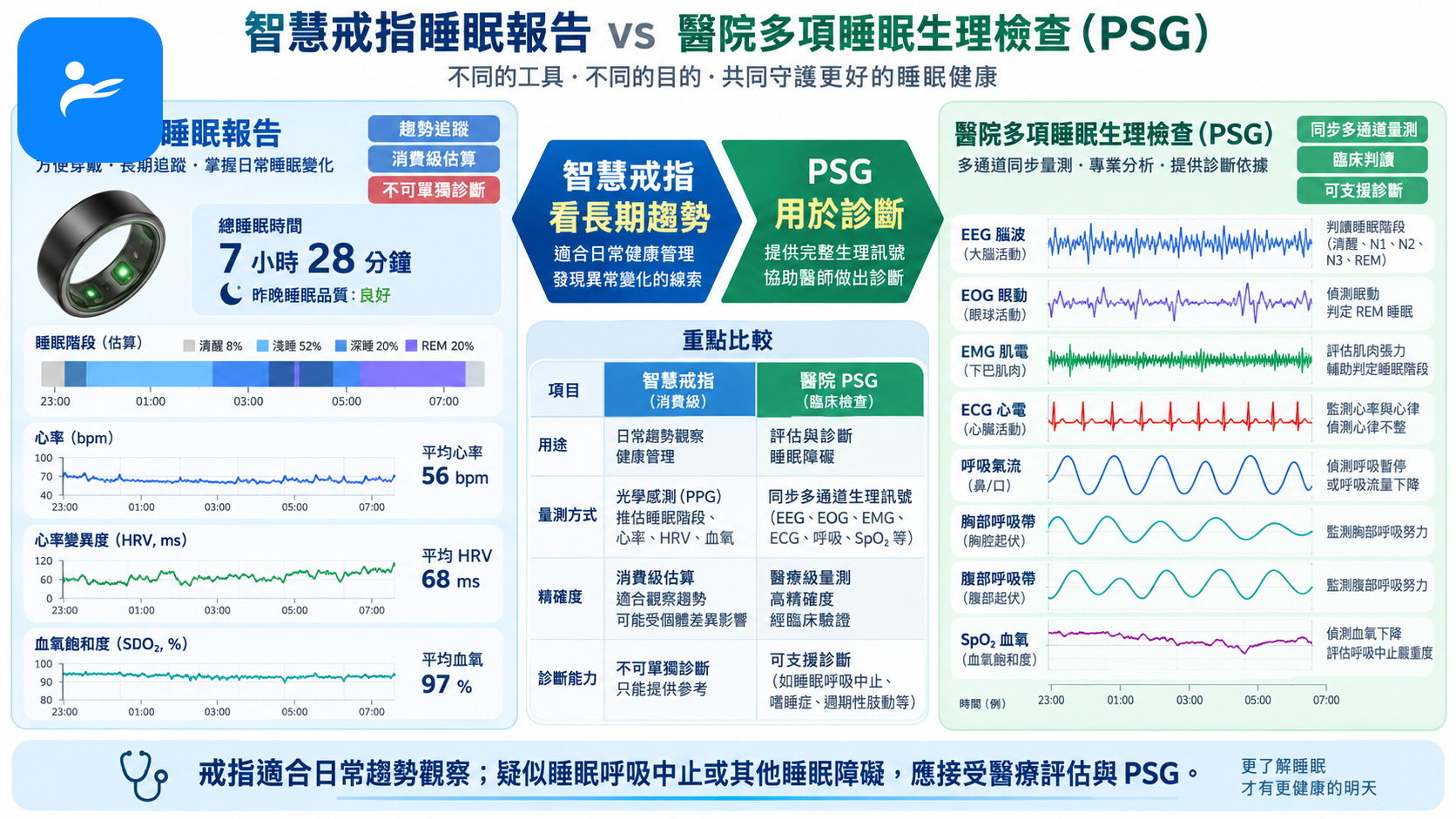 智慧戒指睡眠報告與醫院多項睡眠生理檢查圖表對照,清楚標出趨勢與診斷的差異